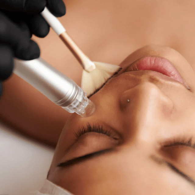 Classic Hydrofacial Package at Relia Aesthetics in Bellevue, WA